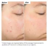 The Ordinary Salicylic Acid 2% Solution mk - Image 2