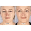 CurrentBody Skin LED Light Therapy Face Mask - Image 2