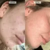 CurrentBody Skin LED Light Therapy Face Mask - Image 4
