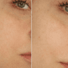 Paula's Choice Resist Daily Pore-Refining Treatment 2% BHA mk - Image 3