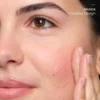 The Ordinary Natural Moisturizing Factors+Beta Glucan - Image 2