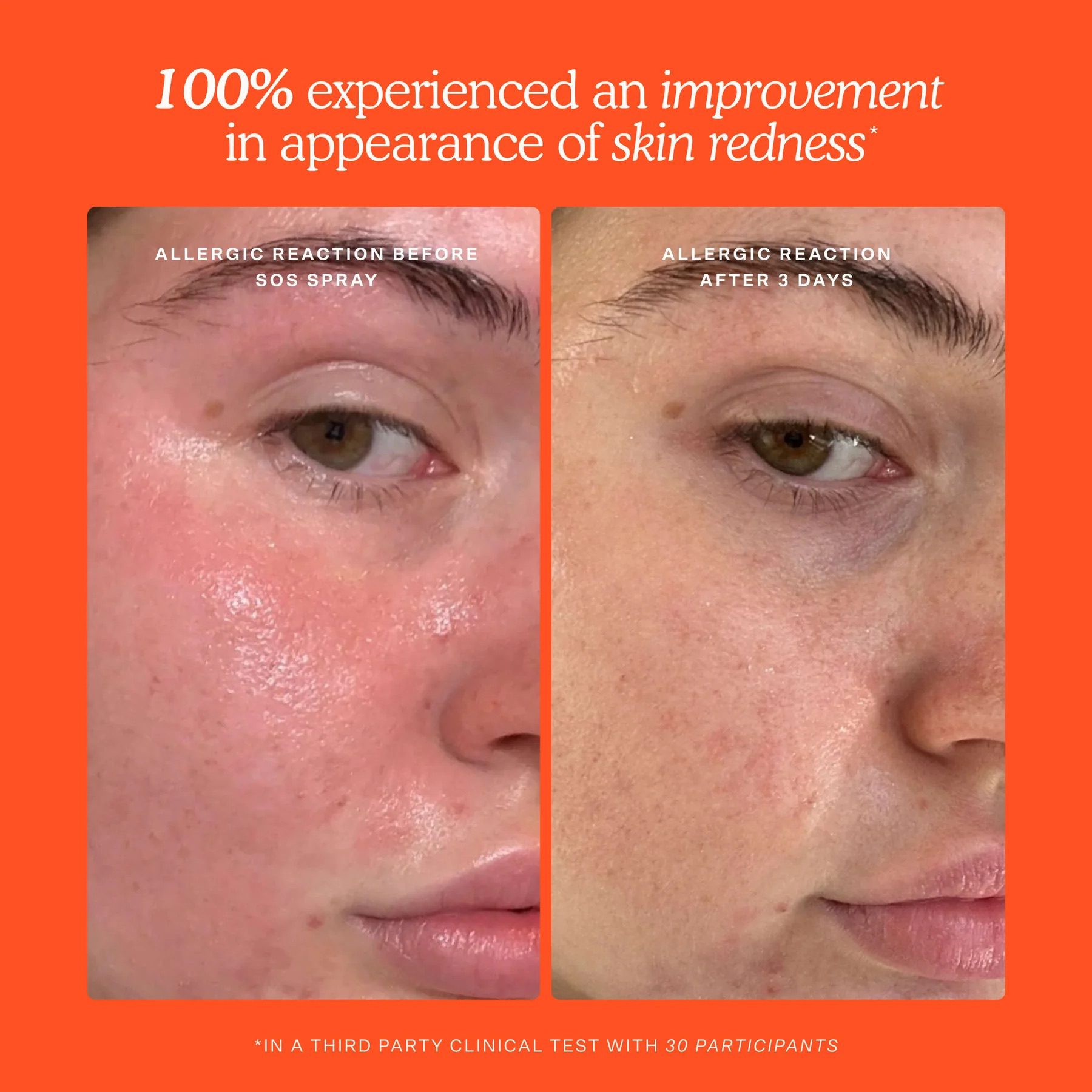 Tower 28 Beauty SOS Skincare Minis Kit - Image 2